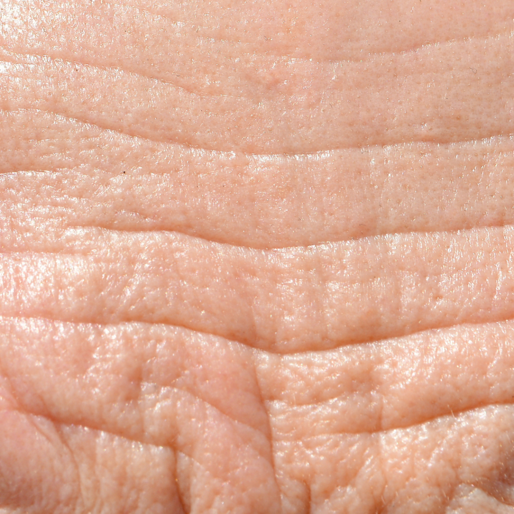 Get Rid Of Wrinkles In Florence Kentucky