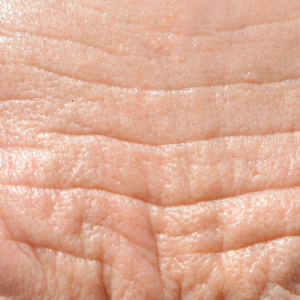 Get Rid Of Wrinkles In Florence Kentucky